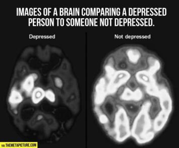 Mental illness is real!